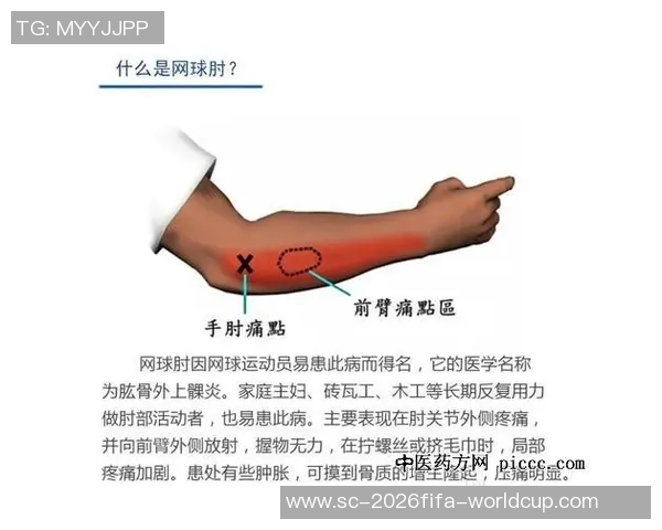 重庆网球队反击之路:从困境到崛起的网球热潮解析 重庆网球队反击之路:从困境到崛起的网球热潮解析
